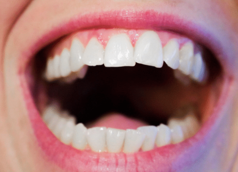 Treating Periodontitis: What Works Best for Healthier Gums