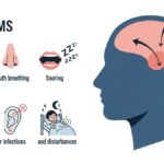 Understanding adenoidid: Causes, Symptoms, and Treatment Options